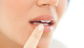 Is Coconut Oil Good for Cold Sores